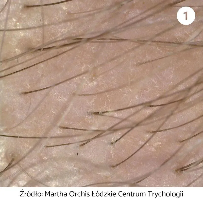 Skóra - największy narząd